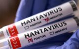 Hantavirüs’de son durum: Birçok ülke vatanda...